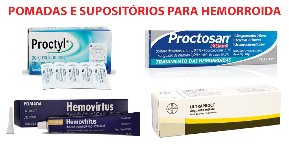 Hemorroida: o que é, causas, sintomas, tratamentos, remédios e cirurgia