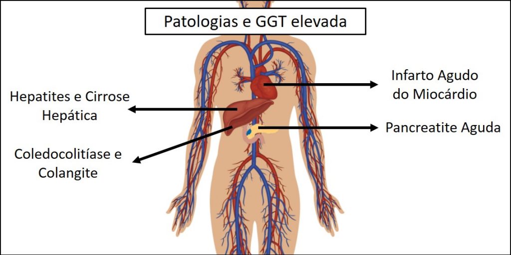 Gama GT (Glutamil transferase) alta: o que isso quer dizer? - IBAP Cursos